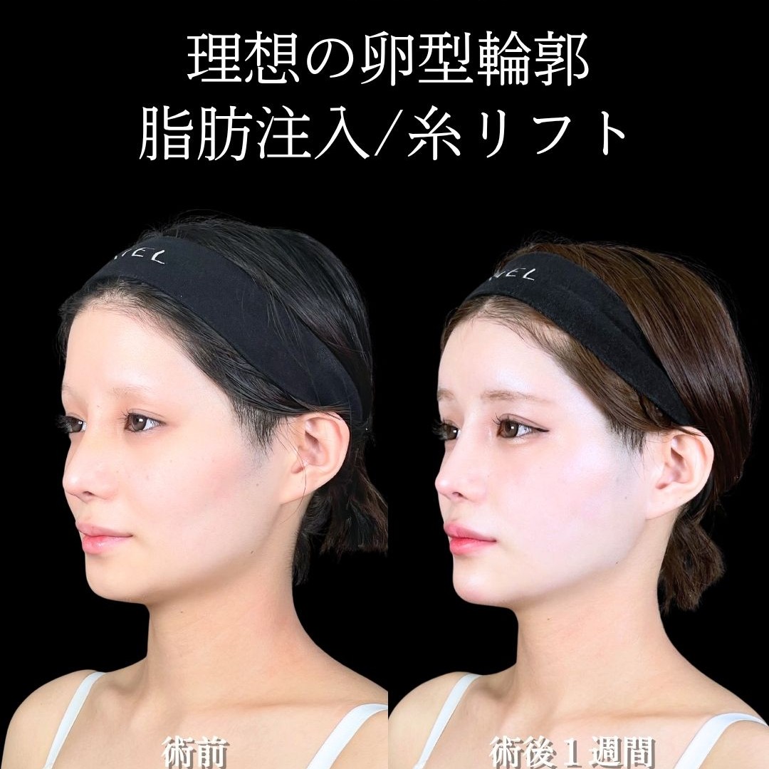 No.16735の症例写真